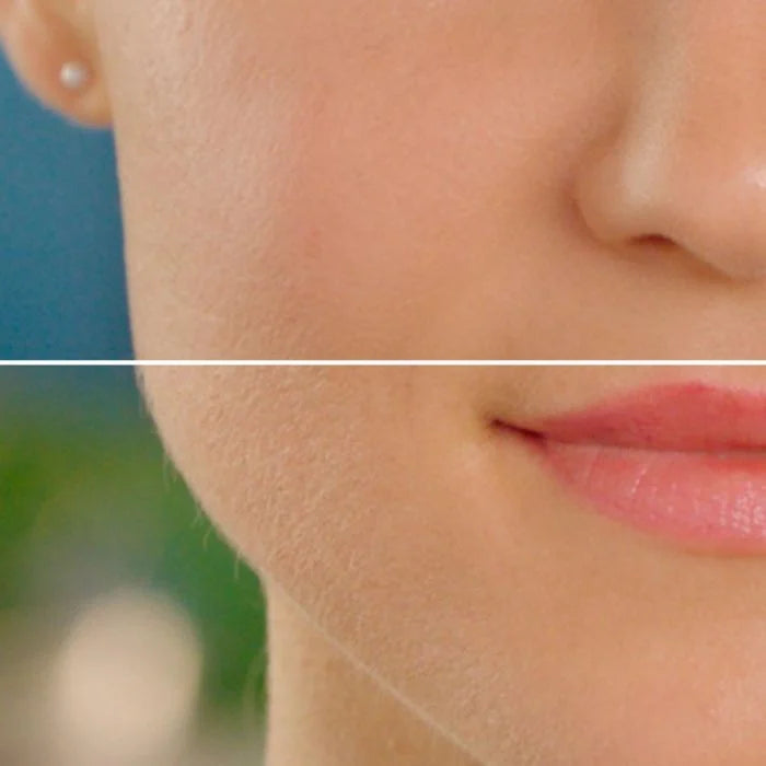 DEPILADORA FACIAL